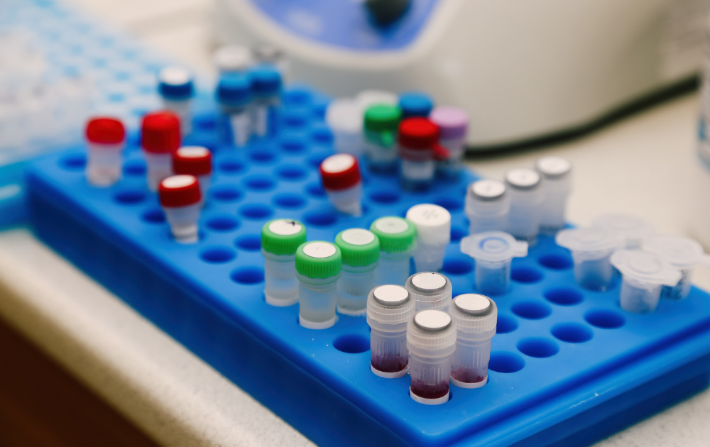 Genetic Testing for Autism: What You Need to Know